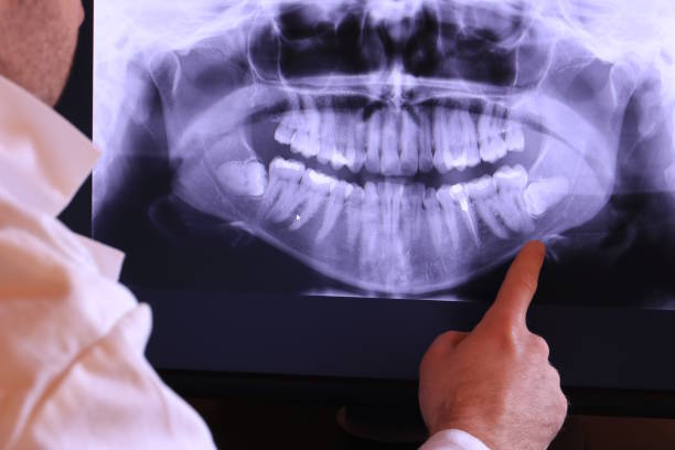 Best Emergency Treatment for Dental Infections or Abscesses in Speer, NC